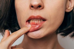Lady shows inflamed gum tissue