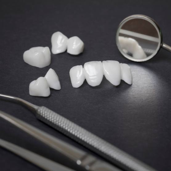 Several white dental crowns and veneers next to dental mirrors