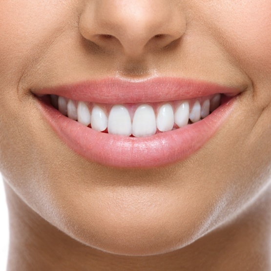 Close up of smile with flawless straight white teeth