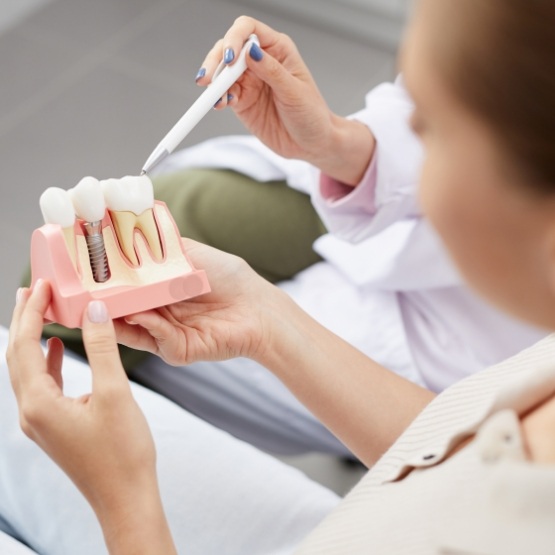Dentist showing a dental implant model to a patient