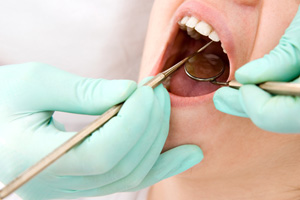 Green-gloved hands examining patient’s mouth