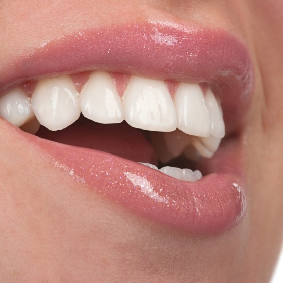 Close up of mouth with flawless white teeth