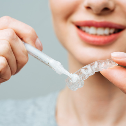 At-home teeth whitening system