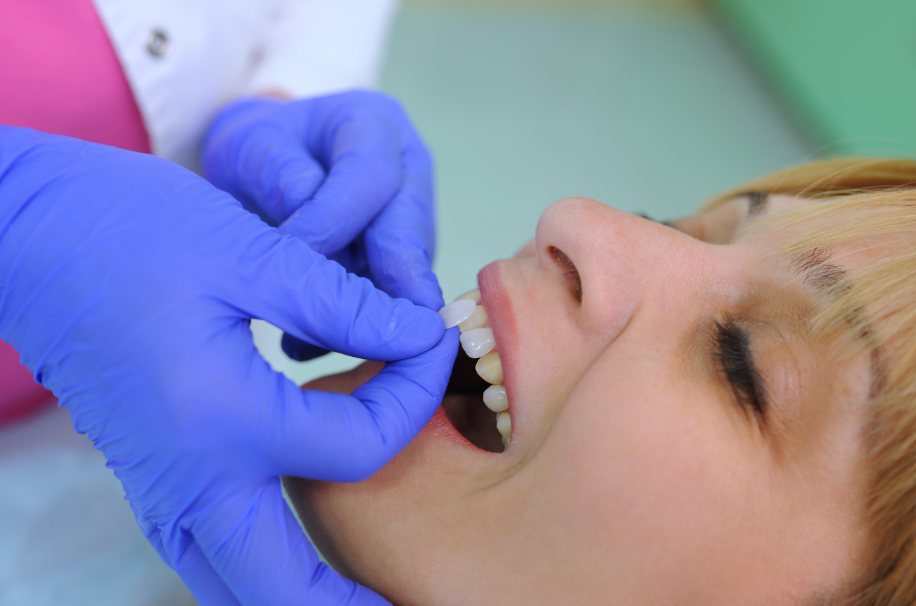 Woman being fitted with veneers