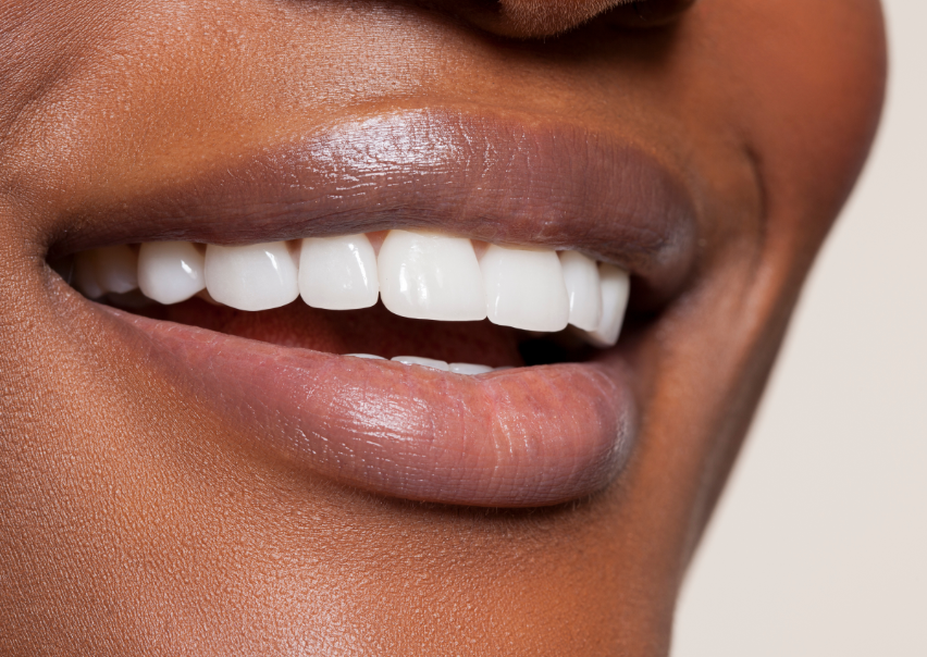 Close up of a woman's smile